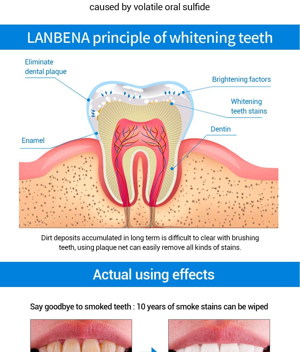Teeth Whitening Essence