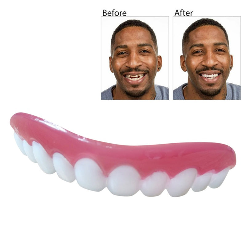 Perfect Smile In Minutes - Professional Veneers